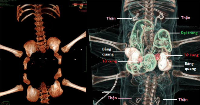 Hành trình 9 giờ từ đường rạch đầu tiên đến phòng hồi sức của 2 bé Trúc Nhi - Diệu Nhi - Ảnh 1.