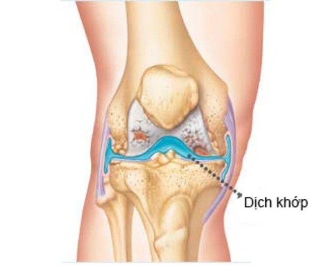 Đừng chủ quan với chứng đau đầu gối: Dấu hiệu nhận biết và cách phòng ngừa sớm - Ảnh 3. Đừng chủ quan với chứng đau đầu gối: Dấu hiệu nhận biết và cách phòng ngừa sớm - Ảnh 3.