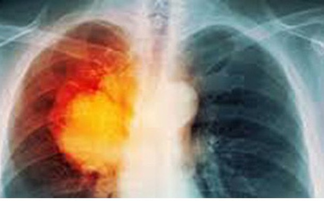 Siêu thực phẩm có thể làm sạch nicotine trong phổi Siêu thực phẩm có thể làm sạch nicotine trong phổi