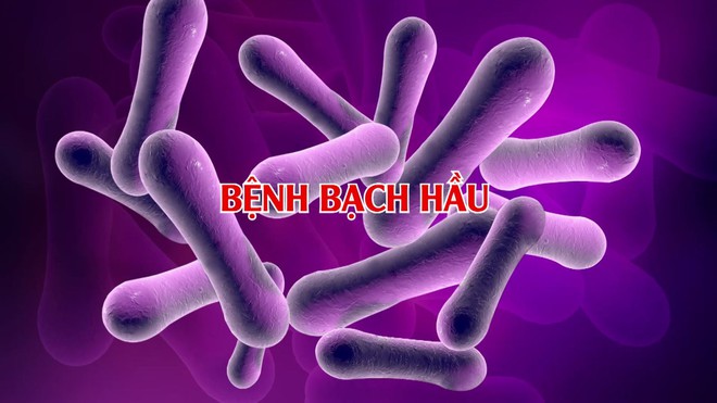 Bệnh bạch hầu tái xuất nguy hiểm: Bác sĩ lưu ý những điều quan trọng - Ảnh 3.