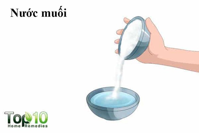 Chữa mắt sưng húp bằng mẹo đơn giản - Ảnh 6.