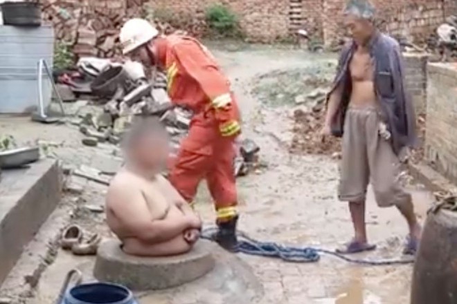 Trung Quốc: Nam thanh niên sống sót thần kỳ nhờ bụng quá to, không lọt nổi xuống giếng - Ảnh 2.