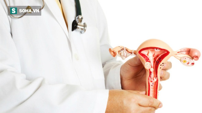 27 tuổi bị 121 khối u xơ tử cung chỉ trong hai năm: Dùng mỹ phẩm tùy tiện hay ăn uống sai? - Ảnh 2. 27 tuổi bị 121 khối u xơ tử cung chỉ trong hai năm: Dùng mỹ phẩm tùy tiện hay ăn uống sai? - Ảnh 2.