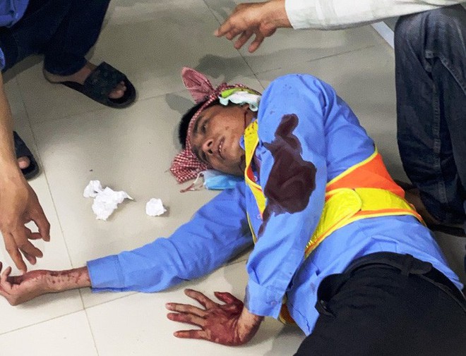 Khánh Hòa: Nhân viên Trạm thu phí BOT Ninh Xuân bị đánh trọng thương - Ảnh 1.