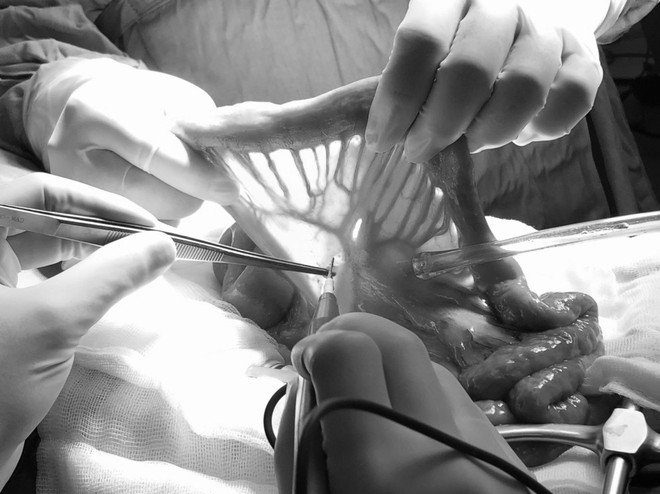 Phát hiện ung thư thanh quản hạ họng từ những triệu chứng...không ngờ! - Ảnh 1.