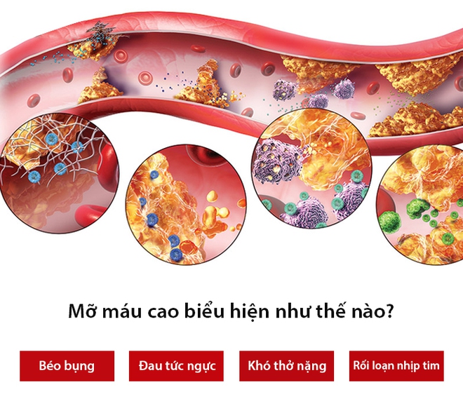 Mỡ máu cao có thể dẫn đến tắc mạch máu, đột tử: 4 sát thủ tàng hình bạn nên tránh xa - Ảnh 1.