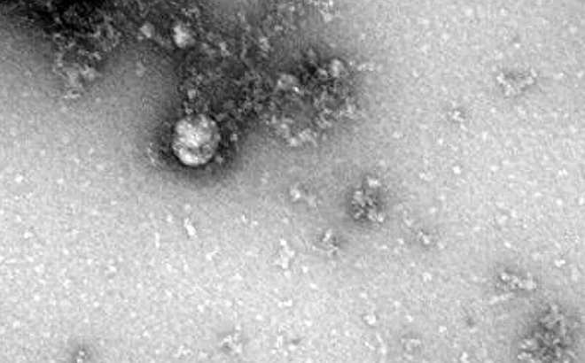 Hình ảnh hiển vi của biến thể virus SARS-CoV-2 mới. Ảnh: Rospotrebnadzor