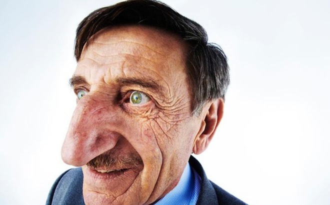 Ông Mehmet Özyürek được ghi nhận là người còn sống có chiếc mũi dài nhất hành tinh. Ảnh: indiatimes.com