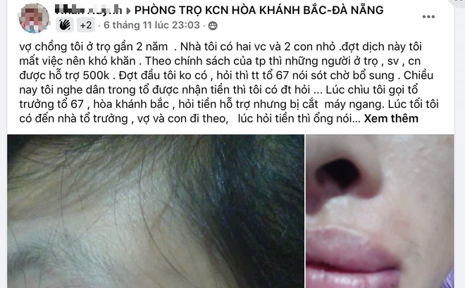 Anh Nh. đăng tải thông tin tố cáo bị đánh khi hỏi tiền hỗ trợ Covid-19 lên mạng xã hội