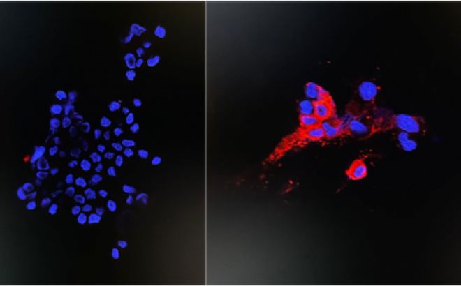 Hình ảnh miễn dịch huỳnh quang để phát hiện protein NP của virus biến thể, nhóm không bị nhiễm (trái) và nhóm bị nhiễm 48 giờ (giữa, phải). Nguồn: Đại học Hong Kong