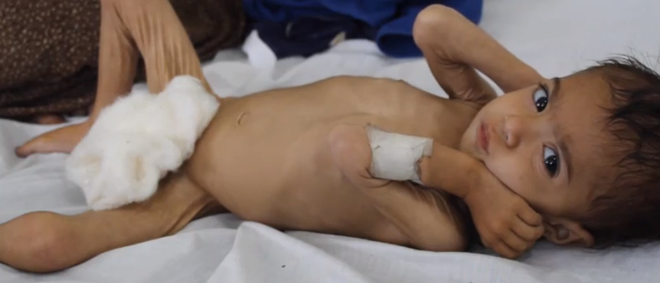 Nạn đói khủng khiếp ở Afghanistan khiến bé 3 tuổi chỉ nặng như trẻ sơ sinh - Ảnh 1.