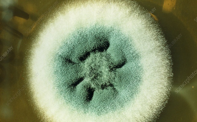 ấm Aspergillus fumigatus được quan sát bằng kính hiển vi. Ảnh: sciencephoto.com