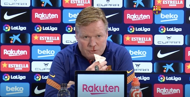 HLV Koeman bỏ dở buổi họp báo của Barca vì bị chảy máu mũi - Ảnh 1.