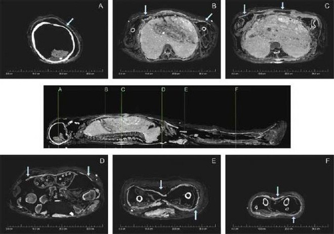 Xác cô gái 3.200 tuổi được ướp xác 2 lần theo cách lạ lùng nhất thế giới - Ảnh 4.