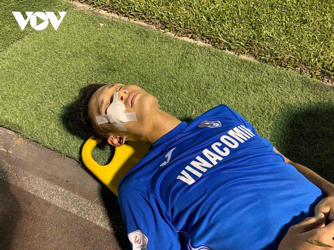 Trung vệ U22 Việt Nam chấn thương nặng trong trận đấu ở vòng 5 V-League 2021 - Ảnh 5.
