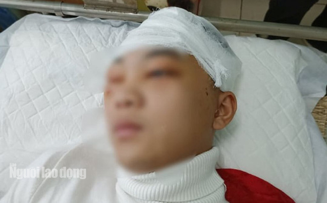Hình ảnh nam sinh bị đánh vỡ sọ não thời điểm đang điều trị tại Bệnh viện Đa khoa tỉnh Thanh Hóa.