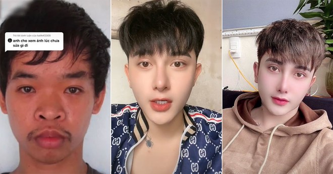 Đi xin việc bị chế giễu ngoại hình, chàng trai Việt đi thẩm mỹ và được lên hẳn báo Singapore - Ảnh 3. Đi xin việc bị chế giễu ngoại hình, chàng trai Việt đi thẩm mỹ và được lên hẳn báo Singapore - Ảnh 3.