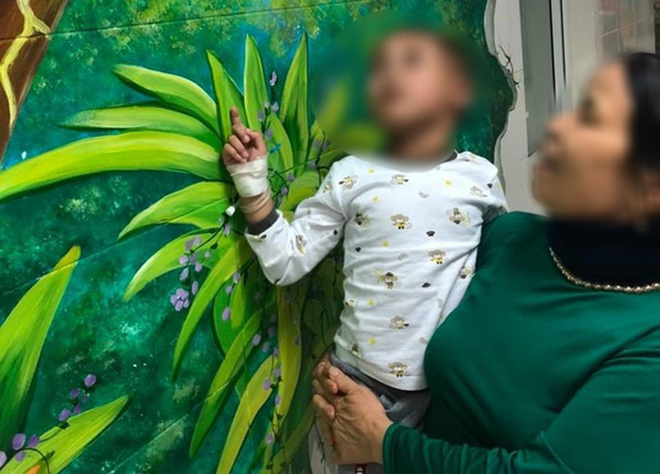 B&eacute; trai hơn 4 tuổi bị ch&oacute; nh&agrave; cắn tổn thương nặng v&ugrave;ng đầu - Ảnh 2.