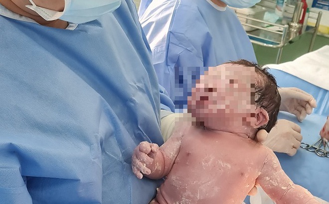 Hình ảnh bé sơ sinh con của bà mẹ ung thư vú sau khi được bác sĩ thực hiện ca sinh mổ