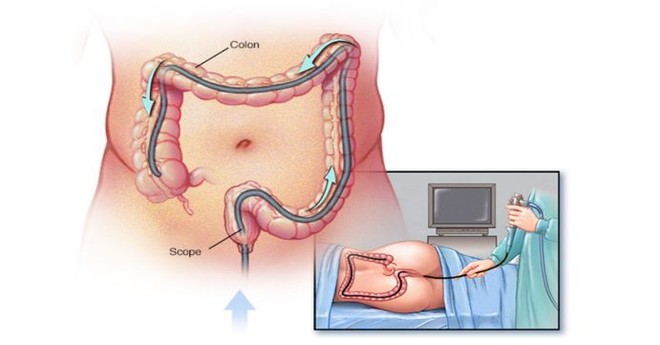 8 cách cải thiện sức khỏe đường ruột - Ảnh 2.