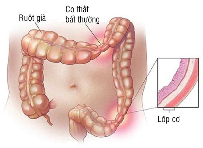 Không ăn mà vẫn thấy no - coi chừng mắc bệnh trọng - Ảnh 4.