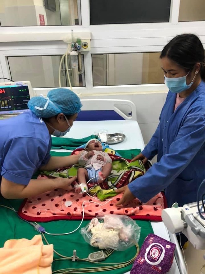 Bệnh viện Răng Hàm Mặt Trung ương HN: Phẫu thuật thành công u gốc lưỡi hiếm gặp cho trẻ 21 ngày tuổi - Ảnh 3.