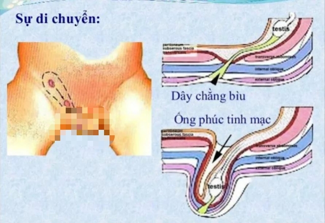 Căn bệnh nguy hiểm cứ 100 trẻ thì có đến 5 trẻ mắc, cha mẹ lại dễ bỏ qua  - Ảnh 2.