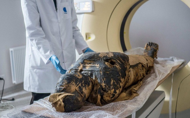 Xác ướp mang thai được đưa vào máy chụp X-quang tại Warsaw, Ba Lan. Ảnh: AFP