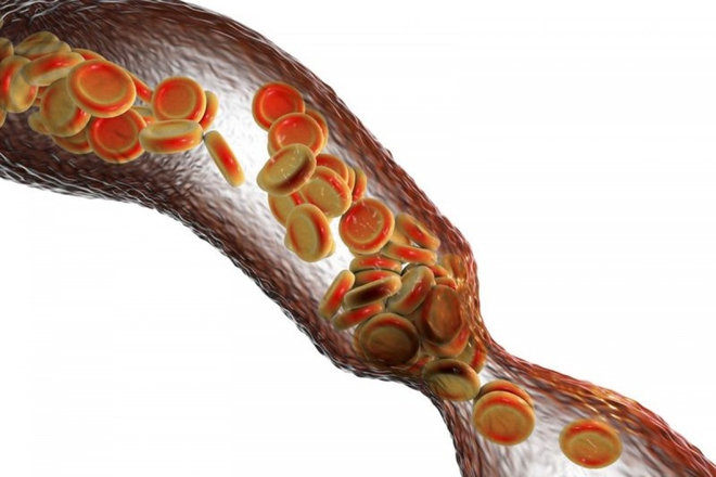 Nguy cơ sức khỏe khôn lường từ ô nhiễm không khí - Ảnh 9.