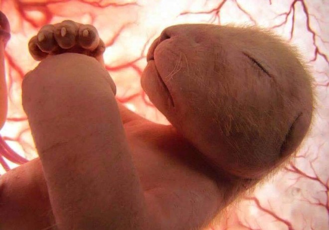 Bộ ảnh rõ từng chân tơ về các loài vật trong bào thai: Bạn có thể nhìn hình đoán xem đây là sinh vật gì? - Ảnh 17.
