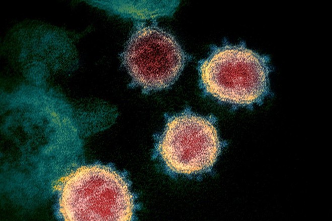 Các nhà khoa học Mỹ đang nghiên cứu siêu vaccine chống chọi được cả họ hàng nhà virus corona? - Ảnh 1. Các nhà khoa học Mỹ đang nghiên cứu siêu vaccine chống chọi được cả họ hàng nhà virus corona? - Ảnh 1.