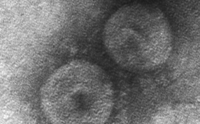 Hình ảnh kính hiển vi điện tử của virus CCov-HuPn-2018 lây sang người được tìm thấy ở một bệnh nhân viêm phổi ở Sarawak, Malaysia. Ảnh: Đại học Ohio
