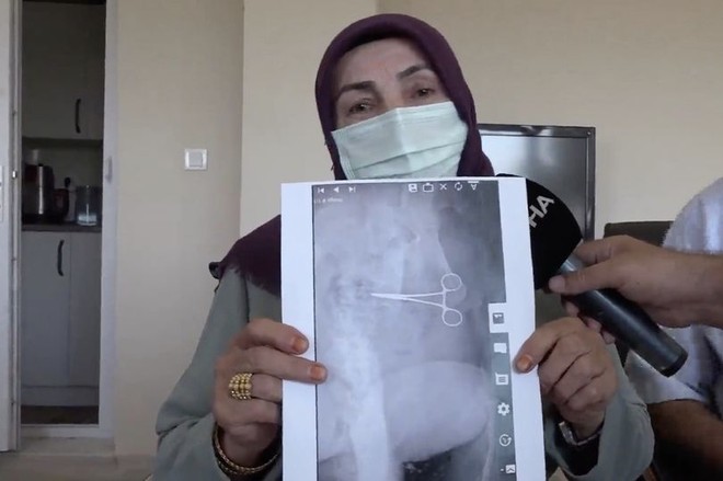 Đau đớn quằn quại sau ca phẫu thuật, người phụ nữ phát hoảng khi xem kết quả chụp X-quang - Ảnh 1.