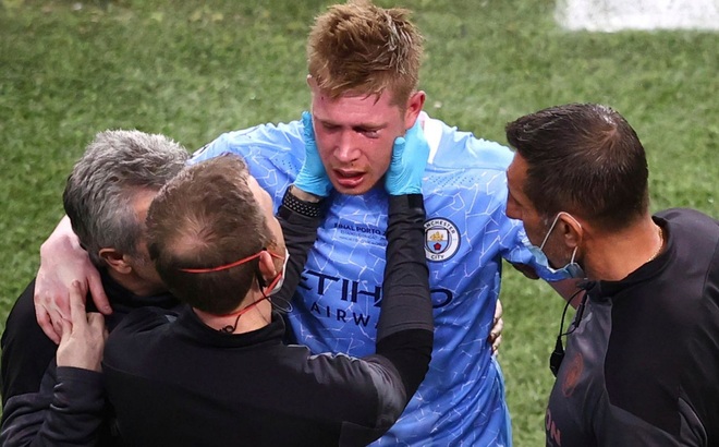 De Bruyne gãy mũi, gãy hốc mắt sau pha va chạm với Rudiger. (Ảnh: Getty)