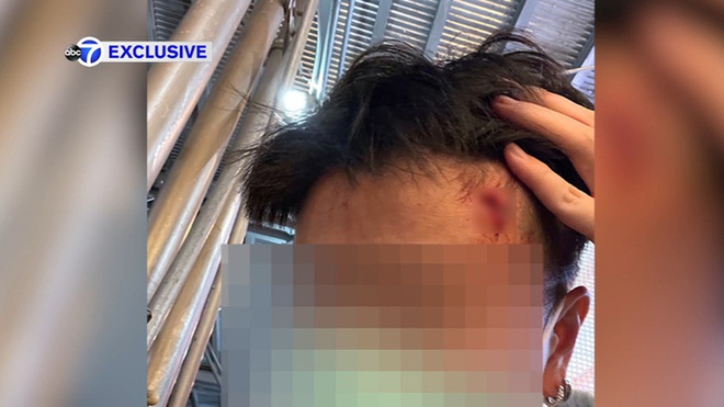 Người phụ nữ gốc Á bị đập búa vào đầu tại New York - Ảnh 1.