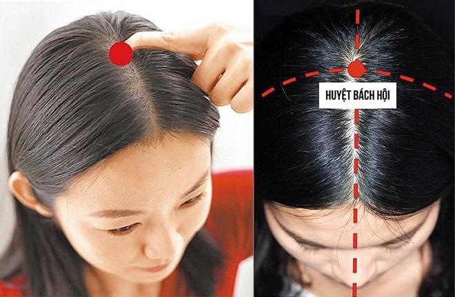 Bài thuốc trị thiếu máu não - Ảnh 2.