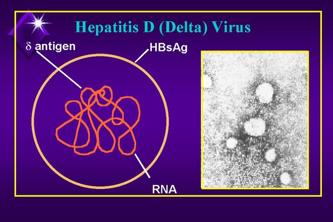 WHO: Virus Delta tràn ra hơn 80 quốc gia, tốc độ lây lan nhanh, có nhiều triệu chứng hơn - Ảnh 2.
