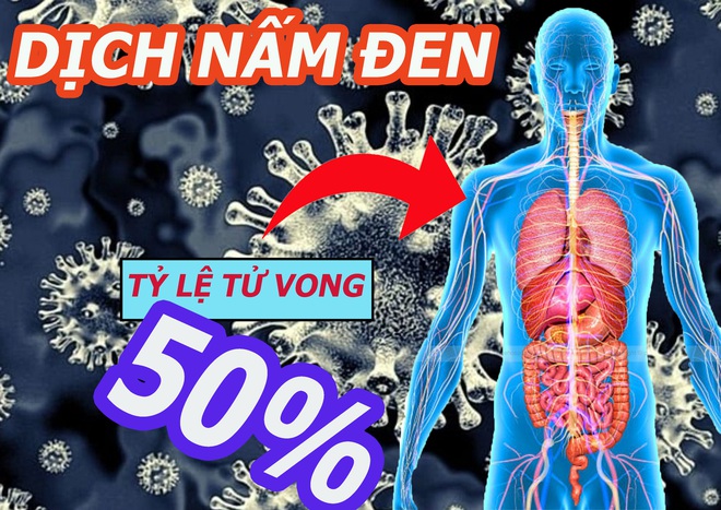 Chưa thoát địa ngục Covid-19, Ấn Độ lại khốn khổ vì bệnh lạ: Điều kỳ lạ của nấm đen! - Ảnh 3.