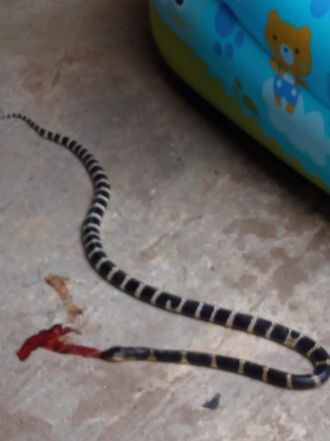 Cháu bé 5 tuổi bị rắn độc cắn, người thân đập chết rắn rồi mang cùng lên viện - Ảnh 2.