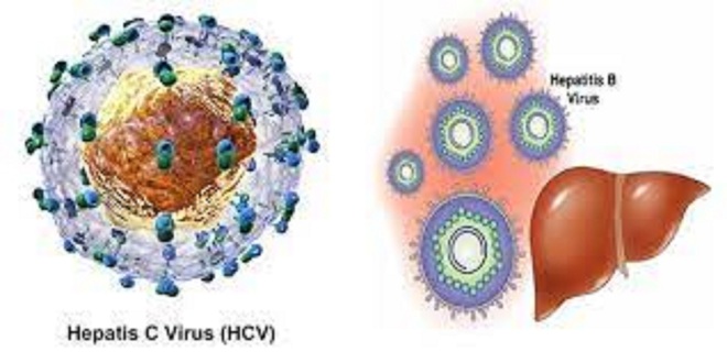 Viêm gan C nguy hiểm thế nào? - Ảnh 1.