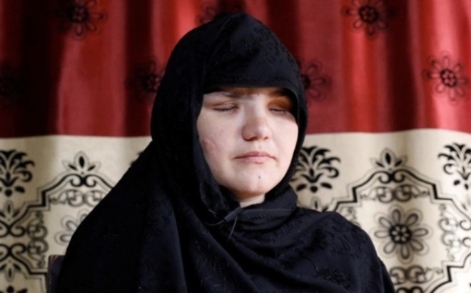 Khatera bị bắn 8 phát và bị phiến quân Taliban khoét mắt. (Ảnh: Reuters)