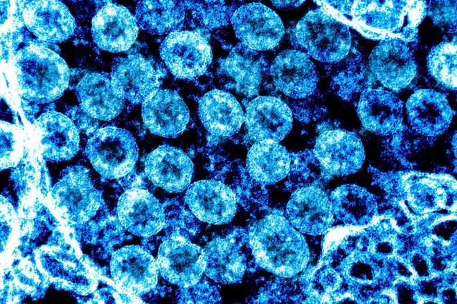 Phát hiện gây choáng: Virus SARS-CoV-2 biến đổi hình dạng để trốn thuốc điều trị; Thêm quốc gia phê duyệt vaccine Sinopharm - Ảnh 1.