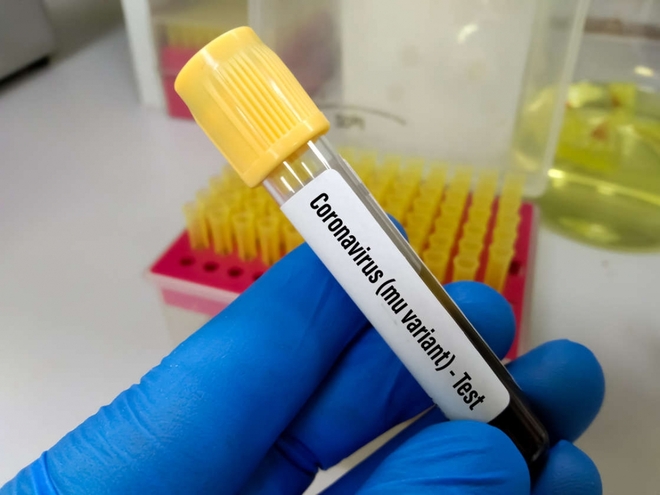Đánh giá mới về vắc xin Sinopharm; Trung Quốc thủng lưới vì một ca nhiễm đặc biệt chưa từng thấy - Ảnh 1.