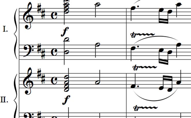 Phát hiện 'chìa khóa' trong bản nhạc của Mozart giúp xoa dịu người bệnh động kinh. Ảnh: wikipedia.org