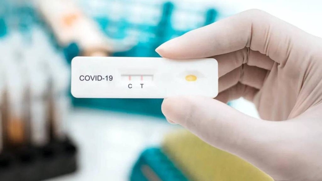 Test nhanh COVID vạch mờ vạch đậm nghĩa là gì? Lý giải của chuyên gia công nghệ sinh học - Ảnh 1.