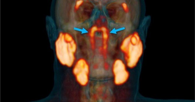 Phát hiện một bộ phận mới trong cơ thể người - Ảnh 3.