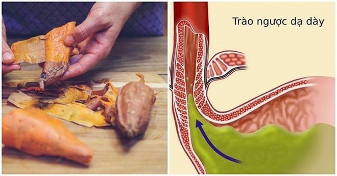 Tuyệt chiêu ăn khoai lang giảm cân Thần Tốc chỉ trong 1 tuần - Ảnh 12.