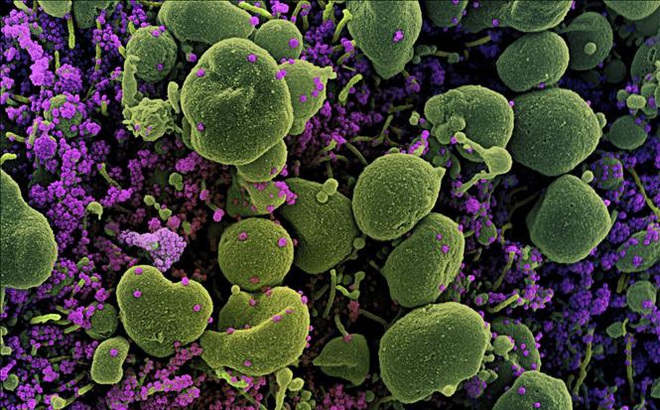 Hình ảnh dưới kính hiển vi do Viện nghiên cứu bệnh truyền nhiễm và dị ứng quốc gia Mỹ cung cấp cho thấy hình ảnh virus SARS-CoV-2 (màu tím) trong tế bào (màu xanh) của bệnh nhân COVID-19. Ảnh: AFP/TTXVN