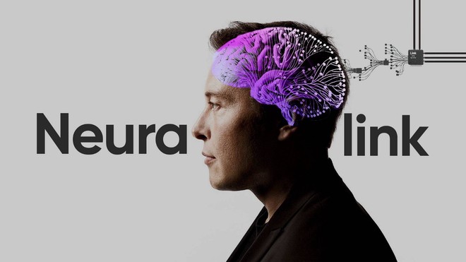 Elon Musk nói sẽ cấy chip vào não người trong năm nay, đây là những gì chúng ta biết về dự án đó - Ảnh 1.