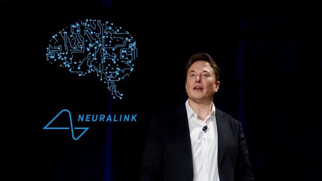 Elon Musk nói sẽ cấy chip vào não người trong năm nay, đây là những gì chúng ta biết về dự án đó - Ảnh 5.
